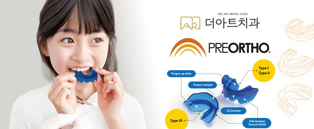 프리올소 장치 — 더아트치과