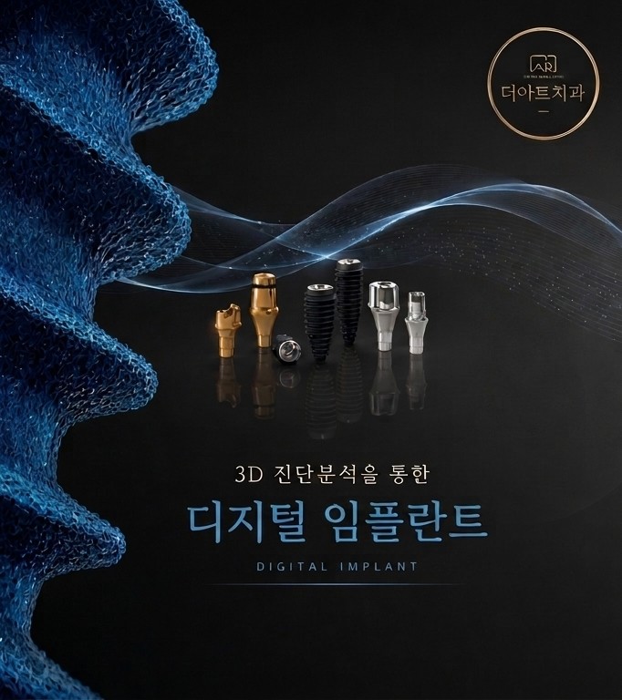 더아트치과 디지털 임플란트